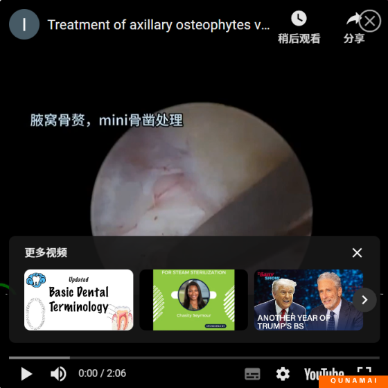 UBE surgery: Cervical corner approach keyhole, axillary osteophyte treatment, mini Angle bone knife and small grinding head