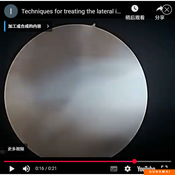 Techniques for handling the lateral part of the intervertebral space