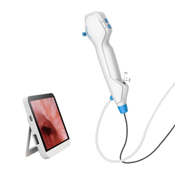 Urological endoscopic surgery - Disposable electronic urological endoscope