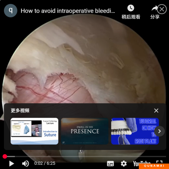 How to avoid intraoperative bleeding during UBE surgery