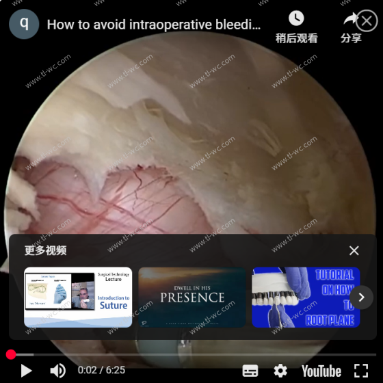 Come evitare emorragie intraoperatorie durante l' intervento chirurgico a UBE
